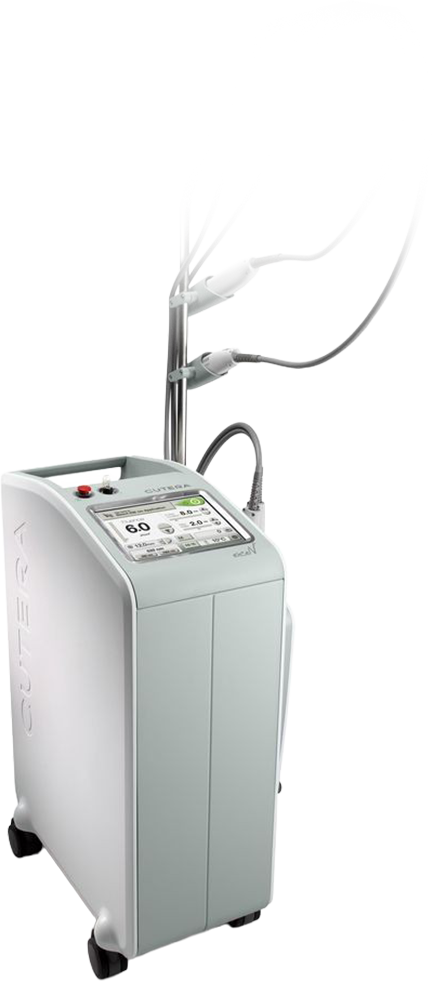 シミ、赤み、色素および肌のハリ改善に使用されるエクセルVレーザー機器